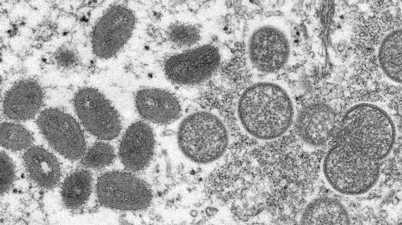 FILE - This 2003 electron microscope image made available by the Centers for Disease Control and Prevention shows mature, oval-shaped monkeypox virions, left, and spherical immature virions, right, obtained from a sample of human skin associated with the 2003 prairie dog outbreak. Cynthia S. Goldsmith, Russell Regner/CDC via AP) 