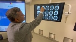 Dr. Bijoy Menon, a University of Calgary researcher involved in the Alteplase Compare to Tenecteplase study, examines brain scans of a stroke victim 
