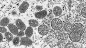 This 2003 electron microscope image made available by the Centers for Disease Control and Prevention shows mature, oval-shaped monkeypox virions, left, and spherical immature virions, right, obtained from a sample of human skin associated with the 2003 prairie dog outbreak. (Cynthia S. Goldsmith, Russell Regner/CDC via AP, file)