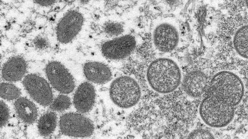This electron microscope image shows mature, oval-shaped monkeypox virions, left, and spherical immature virions, right, obtained from a sample of human skin associated with the 2003 prairie dog outbreak. (Cynthia S. Goldsmith, Russell Regner / CDC via AP, file) 