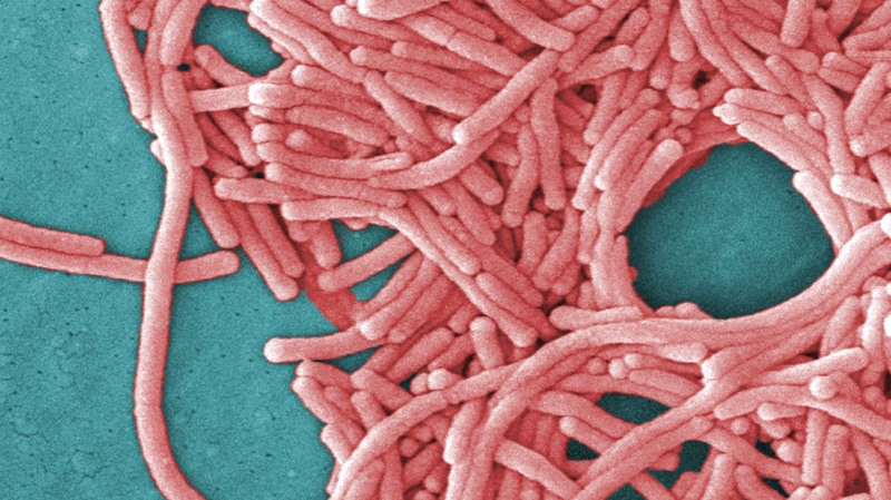 This 2009 colorized 8000X electron micrograph image provided by the Centers for Disease Control and Prevention shows a large grouping of Gram-negative Legionella pneumophila bacteria. THE CANADIAN PRESS/AP-Janice Haney Carr