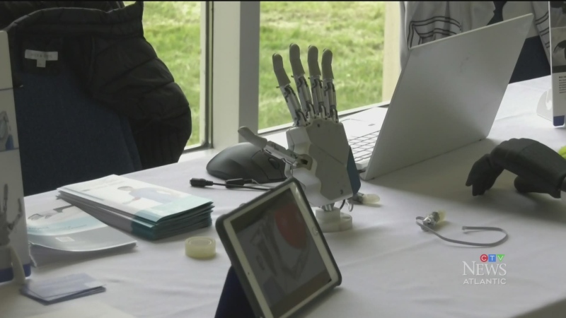 Conference showcases robotic limb technology