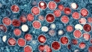 This image provided by the National Institute of Allergy and Infectious Diseases (NIAID) shows a colorized transmission electron micrograph of monkeypox particles (red) found within an infected cell (blue), cultured in the laboratory that was captured and color-enhanced at the NIAID Integrated Research Facility (IRF) in Fort Detrick, Md. (NIAID via AP)