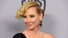 Anne Heche, pictured here on January 7, 2018, in Beverly Hills, California, is 'not expected to survive,' her family says. Heche was involved in a car crash last week. (Chris Pizzello/Invision/AP)