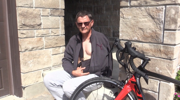 Randy Van Puyenbroeck suffered a broken collarbone, road rash and bruising after being hit by a vehicle while cycling in south London, Ont. on August 14, 2022. (Brent Lale/CTV News London)
