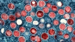 This image provided by the National Institute of Allergy and Infectious Diseases (NIAID) shows a colorized transmission electron micrograph of monkeypox particles (red) found within an infected cell (blue), cultured in the laboratory that was captured and color-enhanced at the NIAID Integrated Research Facility (IRF) in Fort Detrick, Md. The World Health Organization recently declared the expanding monkeypox outbreak a global emergency. It is WHOâ€™s highest level of alert, but the designation does not necessarily mean a disease is particularly transmissible or lethal. (NIAID via AP)