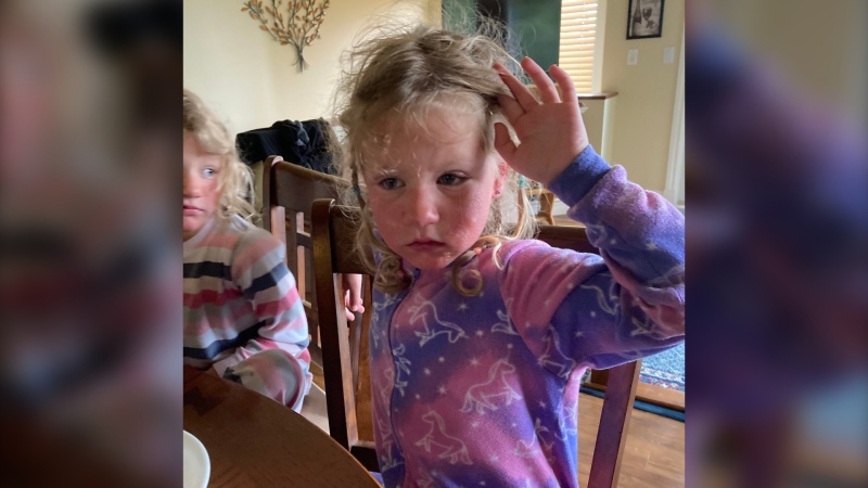 Two children suffering from the effects of Myrtle spurge contact are seen in an image from the Invasive Species Council of B.C. 