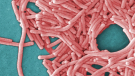 The Simcoe Muskoka District Health Unit is investigating an outbreak of Legionnaire's disease in Orillia, Oct. 7, 2022 (CTV NEWS)
