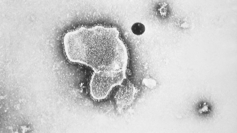 This 1981 photo provided by the Centers for Disease Control and Prevention (CDC) shows an electron micrograph of Respiratory Syncytial Virus, also known as RSV. (CDC via AP, File) 