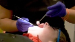 Child gets a dental check up by Dr. Farida Saher in Calgary on Thursday