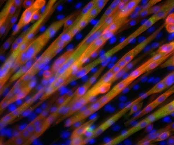In this handout photo made available on Friday Jan. 15, 2010, a photomicrograph of muscle tissue is seen. The muscle fibers are seen diagonally from lower left to upper right. The blue dots are the nuclei of the cells, the yellow color is the result of an overlay (green and red) of two of the most important proteins in skeletal muscle, actin and myosin. (AP Photo/Eindhoven University of Technology/TUE) 