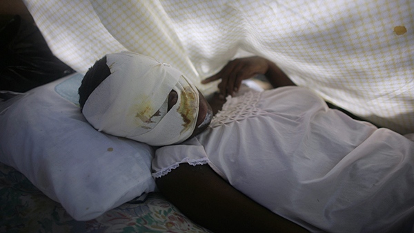A woman injured from Tuesday's earthquake lies in a hospital in Port-au-Prince, Haiti, Saturday, Jan. 16, 2010. (AP / Miguel Tovar)