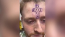 A Vancouver tattoo artist's TikTok video of himself appearing to tattoo the words "hot dogs" on a customer's forehead has garnered nearly 10 million views and thousands of comments.
