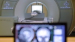 In this Nov. 26, 2014 file photo, a brain-scanning MRI machine at Carnegie Mellon University in Pittsburgh. Ontario is investing more than $20 million in operating costs to run 27 new magnetic resonance imaging machines across the province. THE CANADIAN PRESS/AP-Keith Srakocic