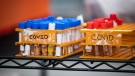 Specimens to be tested for COVID-19 are seen at LifeLabs after being logged upon receipt at the company's lab, in Surrey, B.C., Thursday, March 26, 2020. THE CANADIAN PRESS/Darryl Dyck 