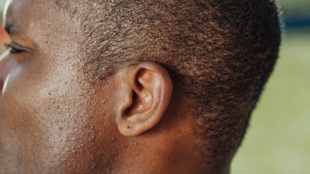 ear, hearing loss