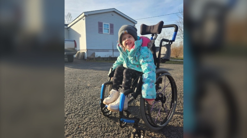 When she was three, Sophie was diagnosed with malan syndrome, which is a rare genetic disorder that only affects about 11 people in Canada.