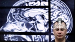 BrainScope employee Doug Oberly wears a brain scanning headset at the NFL owners' meeting in Boca Raton, Fla., Tuesday, March 22, 2016. The headset and mobile app can quickly and easily allow clinicians to determine whether patients have sustained a traumatic brain injury (TBI), the company says. (AP Photo/Luis M. Alvarez)