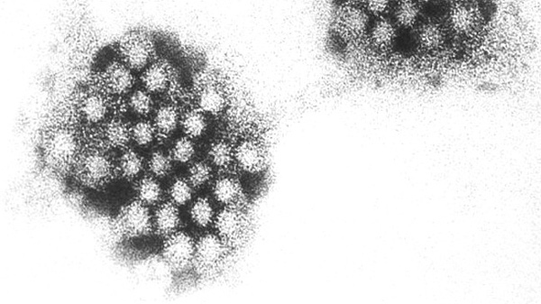 An electron micrograph shows the Norovirus in this undated photo. (U.S. Center for Disease Control and Prevention)