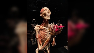 Body Worlds Vital offers a glimpse into the hidden world of human biology with a jaw-dropping display of donated bodies and body parts.