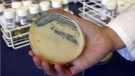 This Oct. 12, 2009 photo shows a petri dish with methicillin-resistant Staphylococcus aureus (MSRA) cultures at the Queen Elizabeth Hospital in King's Lynn, England. (AP Photo/Kirsty Wigglesworth)