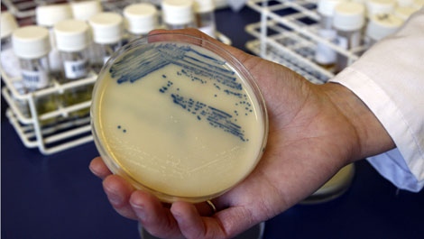 This Oct. 12, 2009 photo shows a petri dish with methicillin-resistant Staphylococcus aureus (MSRA) cultures at the Queen Elizabeth Hospital in King's Lynn, England. (AP Photo/Kirsty Wigglesworth)