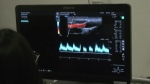 The ultrasound clinic at Camosun College is shown. (CTV News)