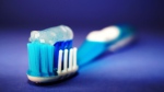 A preliminary study suggests adults who are genetically prone to poor oral health could be at a greater risk of showing signs of declining brain health. (Pexels)