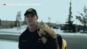 Calgary firefighter Lorne Miller is recovering after two cancer surgeries and two rounds of chemotherapy after a volleyball-sized tumour was discovered in his abdomen