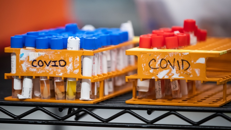 Specimens to be tested for COVID-19 are seen at LifeLabs after being logged upon receipt at the company's lab, in Surrey, B.C., Thursday, March 26, 2020. THE CANADIAN PRESS/Darryl Dyck 
