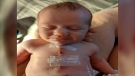 Fetal heart defect undetected before birth