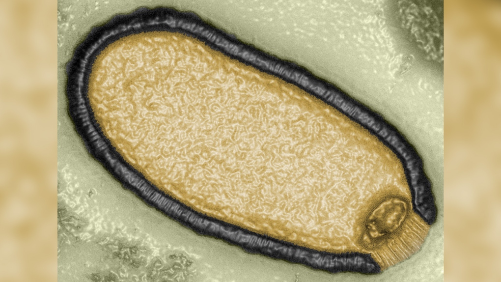 microphoto of Pithovirus sibericum