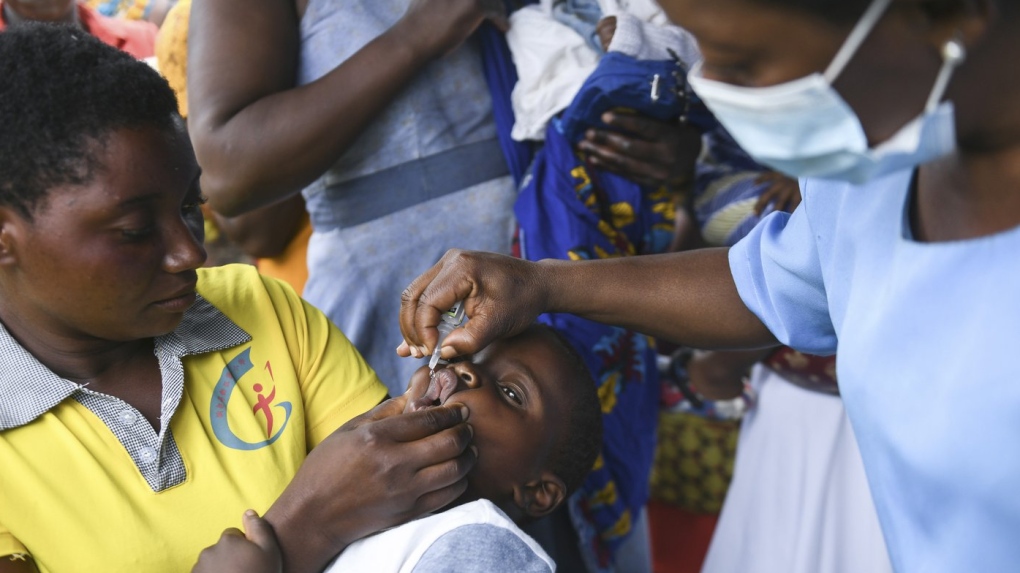 A child receives a polio vaccine
