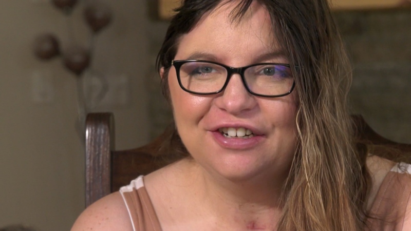 Alberta woman has stroke while pregnant