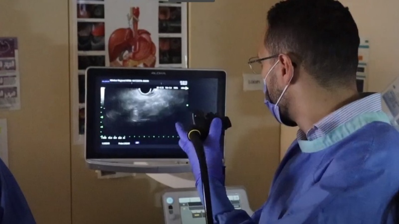 Endoscopic Ultrasound Machine (EUS) now live at Windsor Regional Hospital. (Source: Windsor Regional Hospital/YouTube)