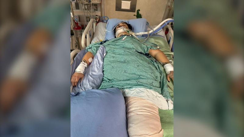 Alexandra Bonilla has been in the ICU since being hit by a car in August. The driver left the scene, and police are asking anyone with information to contact them. (Source: Julia Gevenich)