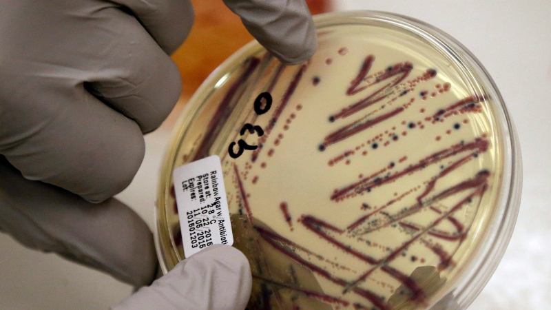 A microbiologist points out an isolated E. coli growth on an agar plate from a patient specimen at the Washington State Dept. of Health Tuesday, Nov. 3, 2015, in Shoreline, Wash. (AP Photo/Elaine Thompson)