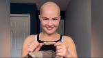 Local woman marks Alopecia Awareness Month