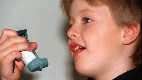 Aaron, 8, gets ready to take his Asthma medicine called ventolin by inhaling it.  (CP PHOTO) 