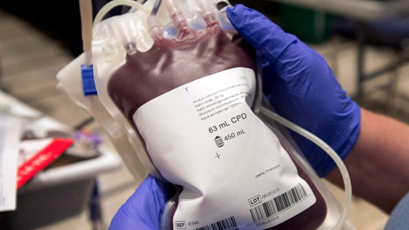 Health Canada approves nationwide removal of blood donor ban sparked by mad cow fears