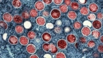 This colorized electron microscope image provided by the National Institute of Allergy and Infectious Diseases shows mpox particles, red, found within an infected cell, blue, cultured in a laboratory in Fort Detrick, Md. (NIAID via AP, File)