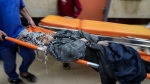 Palestinians wounded in the Israeli bombardment of the Gaza Strip are brought to the hospital in Deir al Balah on Sunday, Dec. 3, 2023. (AP Photo/ Hatem Moussa) 