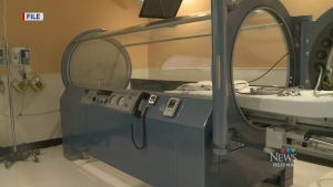 Hopes to bring back hyperbaric chamber
