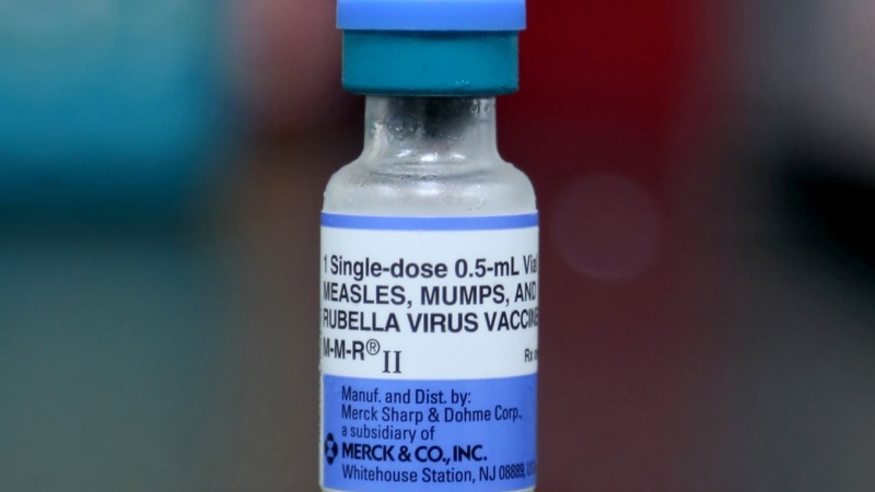 A measles vaccination is in Mount Vernon, Ohio, in a May, 2019 file photo. THE CANADIAN PRESS/AP/Paul Vernon