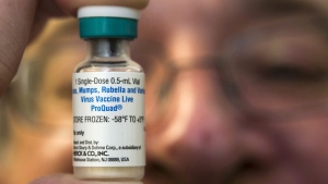 A pediatrician holds a dose of the measles-mumps-rubella (MMR) vaccine at his practice in Northridge, Calif. on Jan. 29, 2015. THE CANADIAN PRESS/AP, Damian Dovarganes