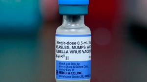 A measles vaccination is shown in Mount Vernon, Ohio in a May 2019 file photo. AP/Paul Vernon