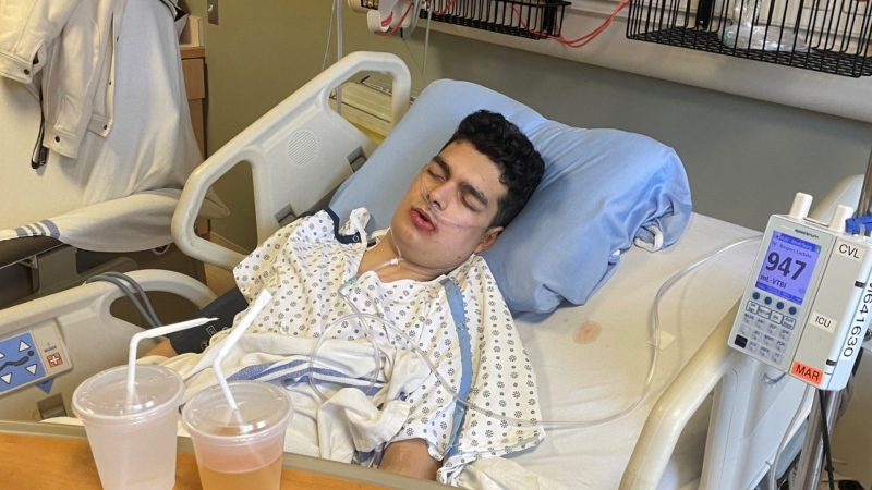 Jacob Geraldo Mejia, 17, was sent to Foothills hospital on March 16 and had surgery two days later for a fractured jaw due to a random attack by a stranger.