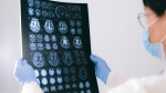 In this stock photo, a doctor examines MRI scans of a brain. (Anna Shvets / pexels.com)