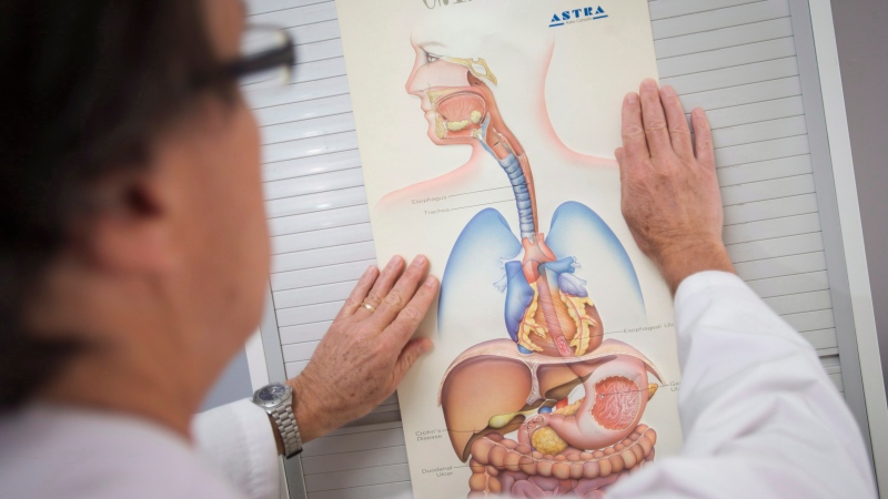 Dr. Lawrence Cohen, a specialist in gastroenterology, puts up a poster depicting the human gastrointestinal tract at the Sunnybrook Health Sciences Centre in Toronto on Thursday, August 7, 2014. THE CANADIAN PRESS/Darren Calabrese