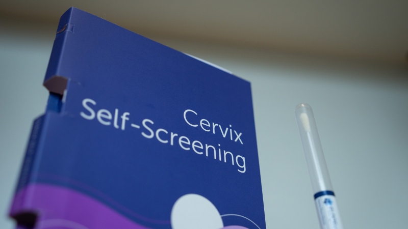 A cervix self-screening kit is a part of the first self-screening cervical cancer plan in Canada, in Vancouver, Tuesday, Jan. 9, 2024. THE CANADIAN PRESS/Ethan Cairns